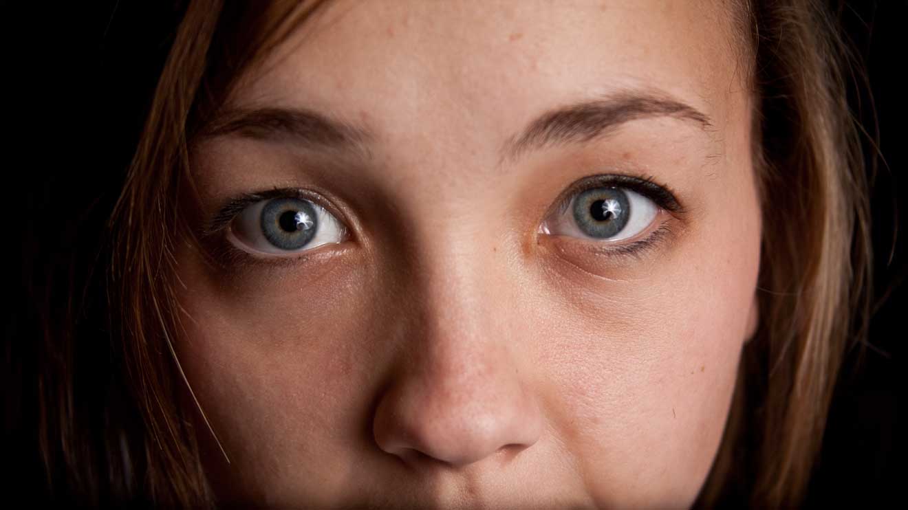 Gibt es das Cortisol-Face – also das stressbedingt aufgedunsene Gesicht– tatsächlich? Wir haben nachgefragt. - iStock/justinkendra